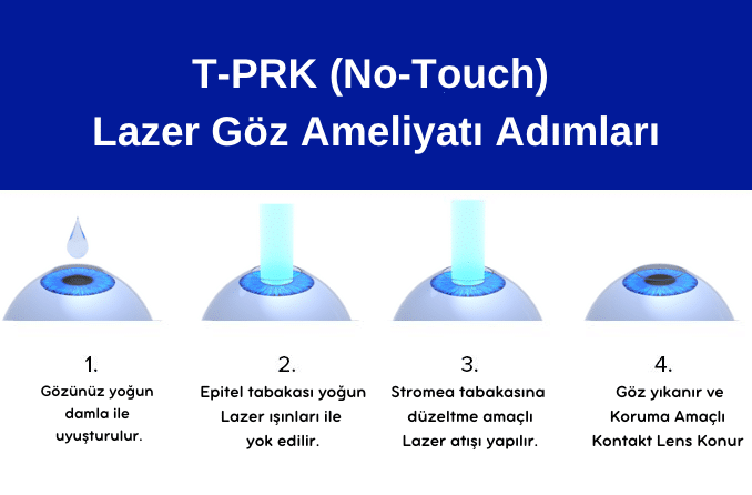 No Touch, T-PRK, Lazer Göz Ameliyat